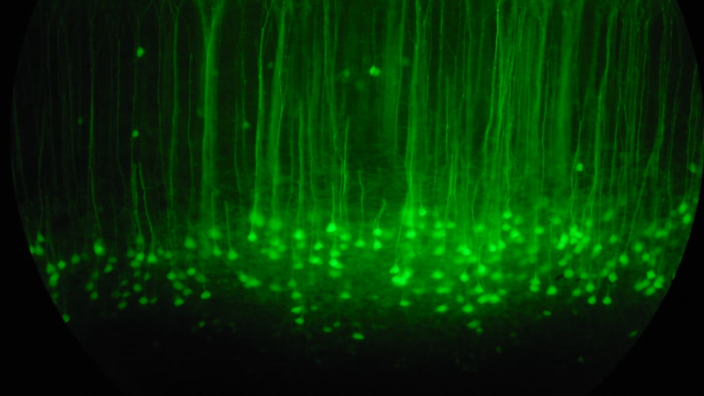 Mouse somatosensory cortex with green fluorescent protein-labeled neurons at 20x magnification